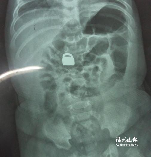 �ܺ���ι2���´�ܵܳ�ƽ���� �������ڴ���5��