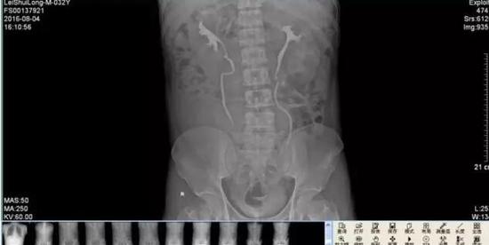 �������ᱳʹһ�龹��4���� ������Լʮ���һ